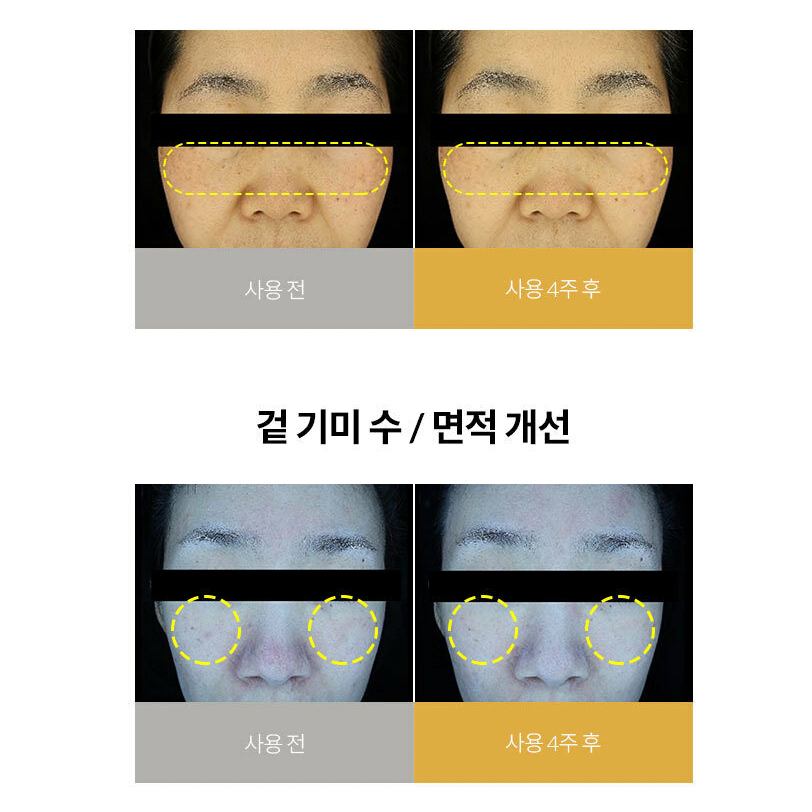 Mặt nạ MEDI ANSWER Vita Collagen Mask 37g