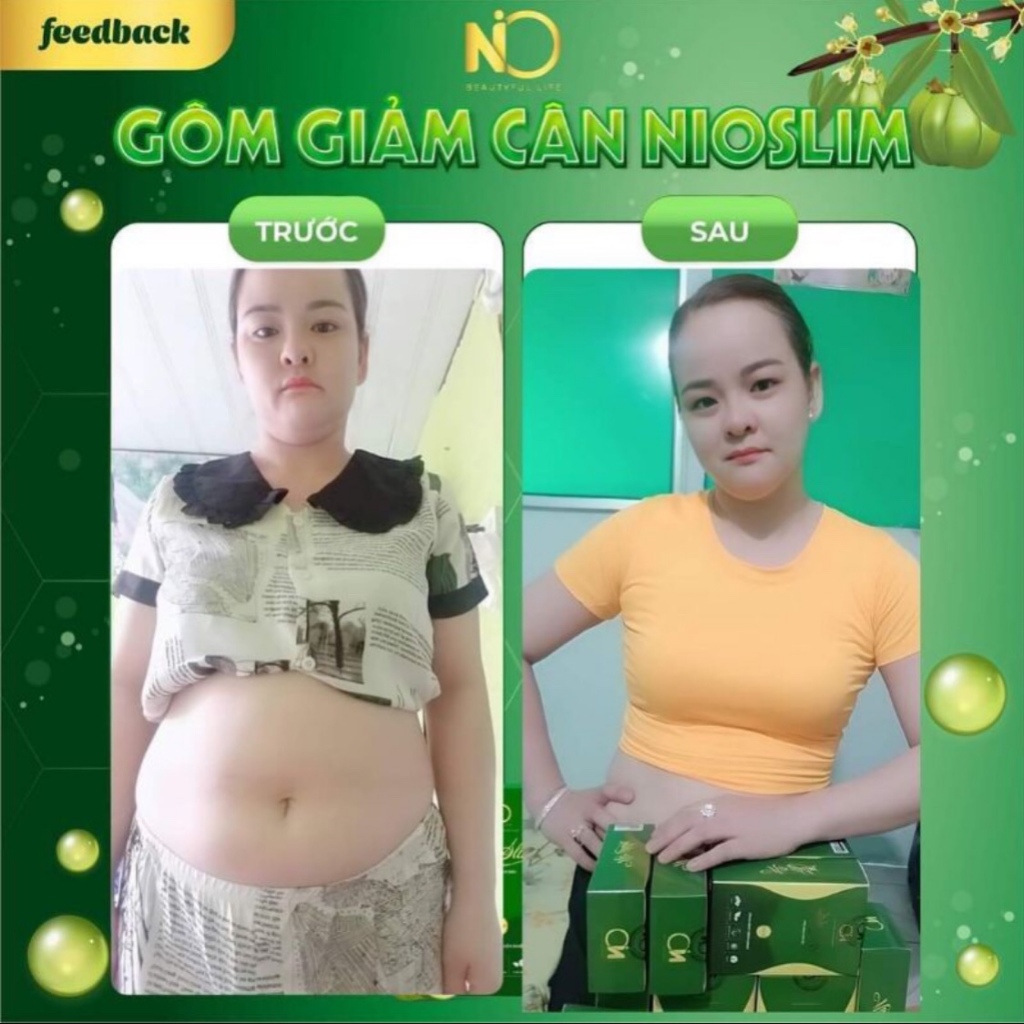 Giảm Cân Nio Slim X2, Kẹo Gôm Giảm Cân Nio Slim X2 Mẫu Mới Chính Hãng tặng kèm detox rau củ