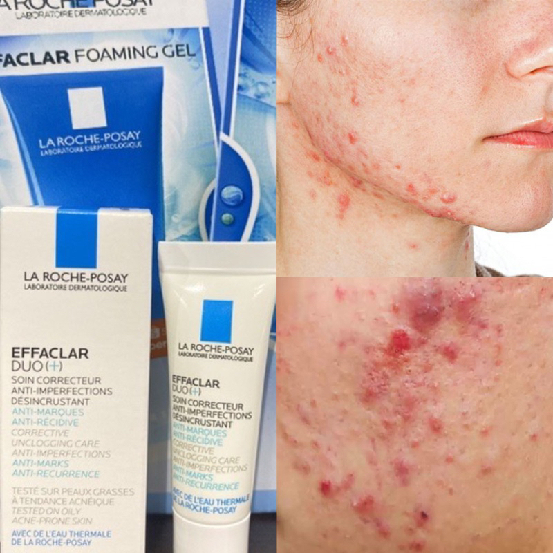 Gel dưỡng dành cho da mụn, vết thâm La- Roche Posay Effaclar Duo+ 3ml