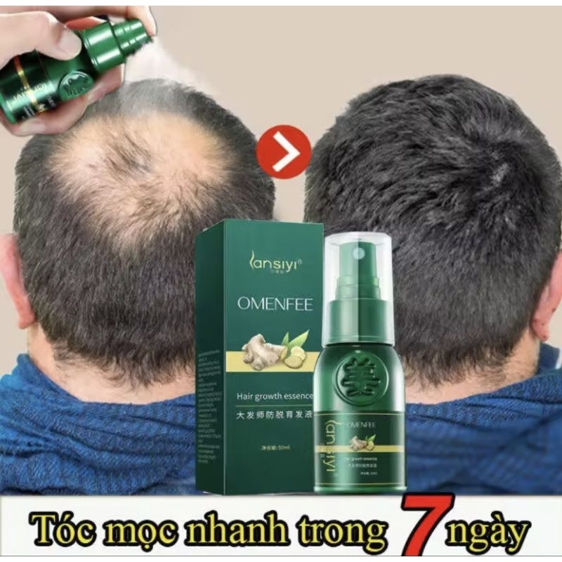 Serum Mọc Tóc Nhanh Tinh Chât Chiét Xuât Gừng Tự Nhiên