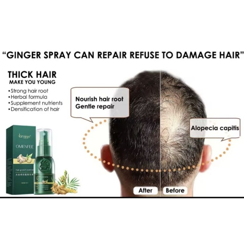 Serum Mọc Tóc Nhanh Tinh Chât Chiét Xuât Gừng Tự Nhiên