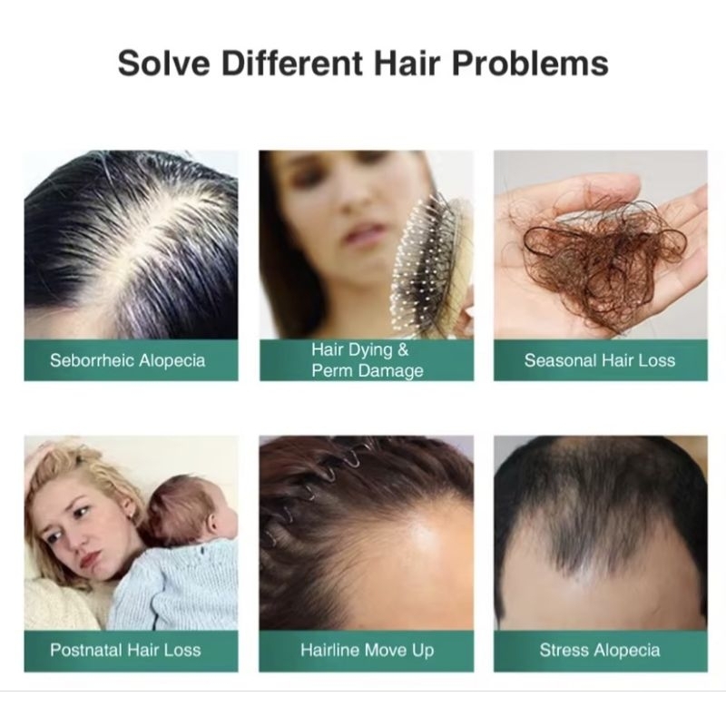 Serum Mọc Tóc Nhanh Tinh Chât Chiét Xuât Gừng Tự Nhiên