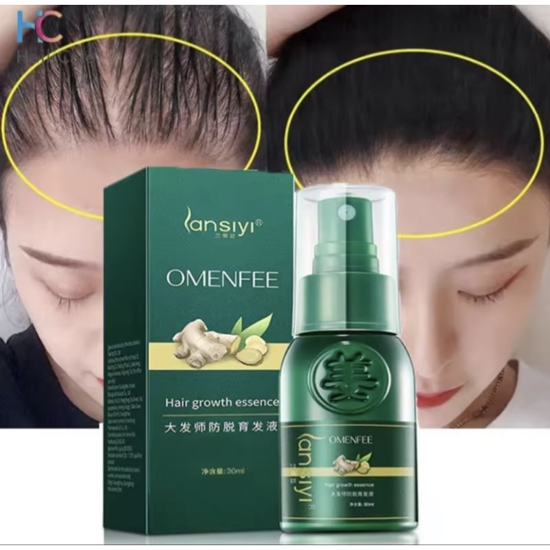 Serum Mọc Tóc Nhanh Tinh Chât Chiét Xuât Gừng Tự Nhiên