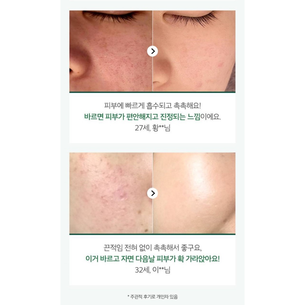 Kem Dưỡng Trắng Và Cải Thiện Nếp Nhăn SUNGBOON Cocklebur Namomi Repair Cream Plus 50ml - Mibebe