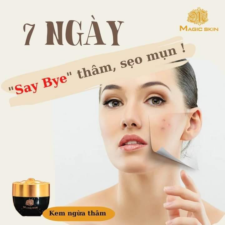 Kem ngừa thâm Magic skin Anti Bruise Cream