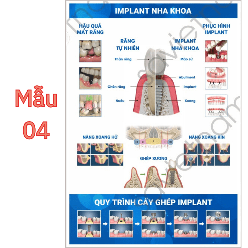 Tranh tư vấn dịch vụ nha khoa nhiều chủ đề: thẩm mỹ, implant, giải phẫu răng, bệnh nha chu, ...