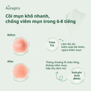 Miếng dán mụn The Auragins Acne Rescue Patch