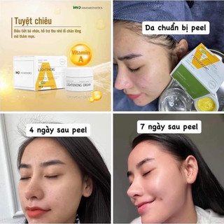 Peel da Vitamin A 5% LIGHTENING (lọ full)