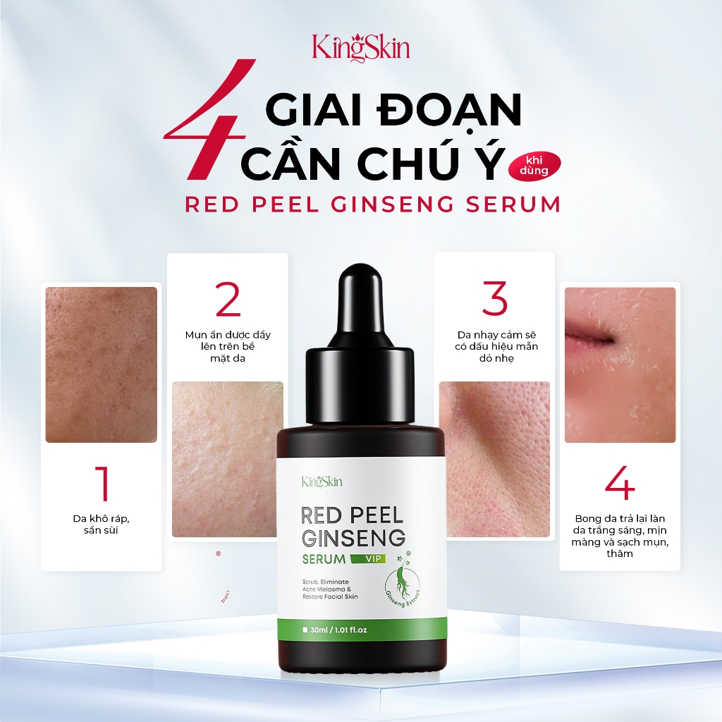 FREESHIP COMBO GIẢM MỤN RED PEEL VIP KING SKIN