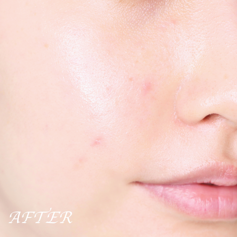 BỘ DƯỠNG TÁI SINH DA OHUI THE FIRST GENITURE SPECIAL SET