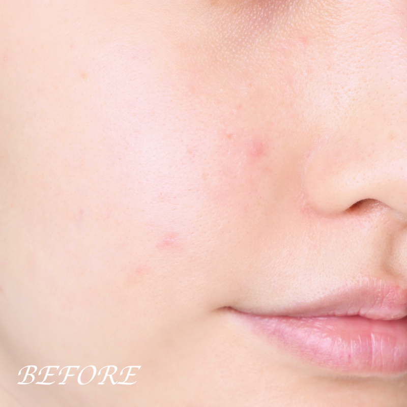 BỘ DƯỠNG TÁI SINH DA OHUI THE FIRST GENITURE SPECIAL SET