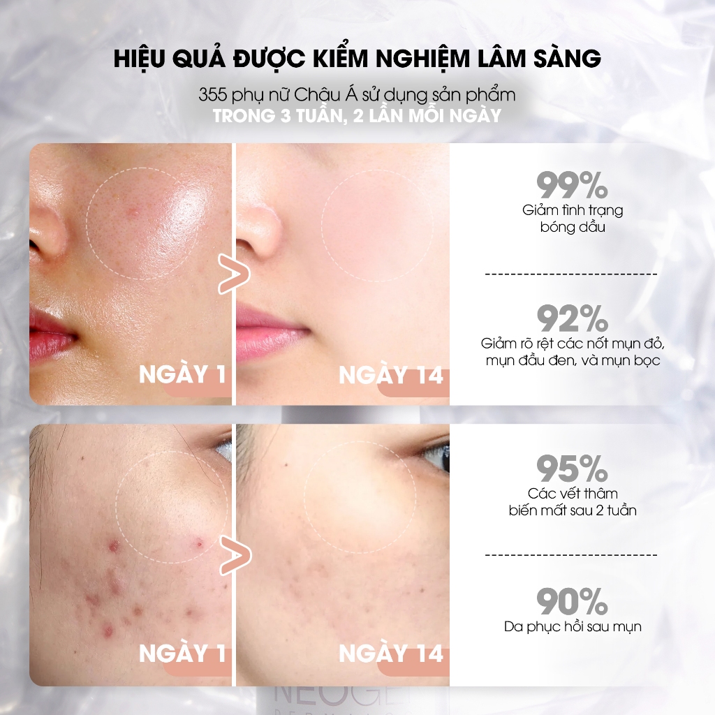 Serum 15% Niacinamide Sinh Học Kiềm Dầu Giảm Mụn Dưỡng Sáng Da Neogen Dermalogy Real Niacinamide Firming 30ml