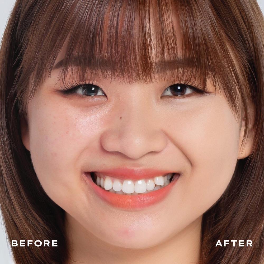 Thanh che khuyết điểm Gadania chính hãng 4g