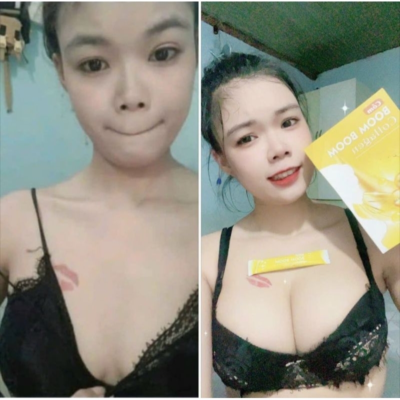 Colagen cốm bom bom