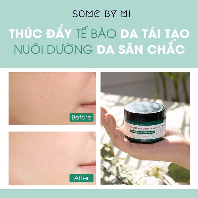 Kem Dưỡng Loại bỏ Mụn Some By Mi AHA-BHA-PHA 30 Days Miracle Cream