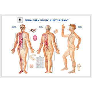 Tranh đông y, tranh y tế, tranh châm cứu, diện chẩn, tranh