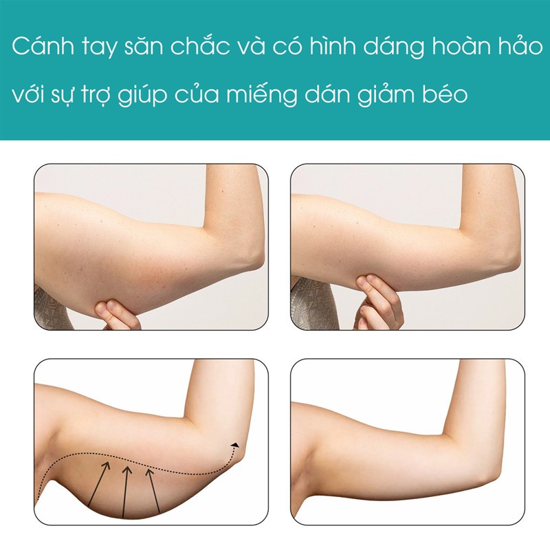 12 miếng dán giảm béo cánh tay giảm cân cho người lười giảm béo giảm cân đốt cháy mỡ cánh tay sản phẩm giảm cân an toàn