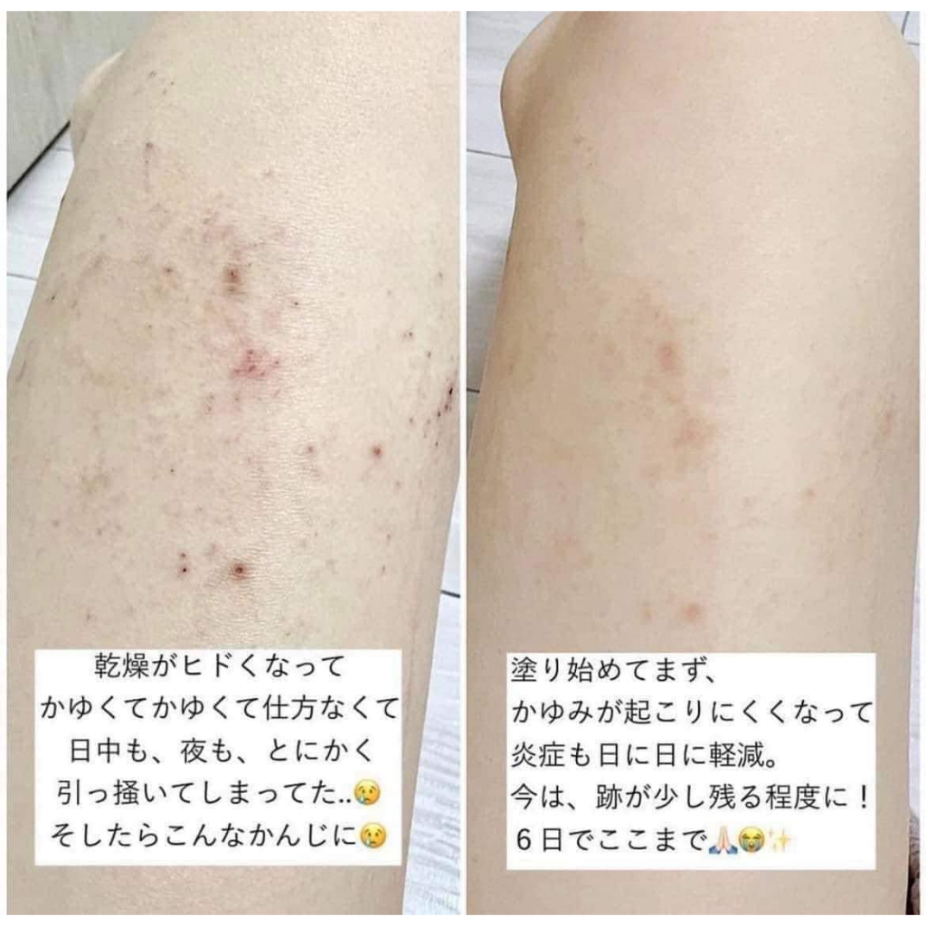 Kem dưỡng da tay retinol Manuan 83gr