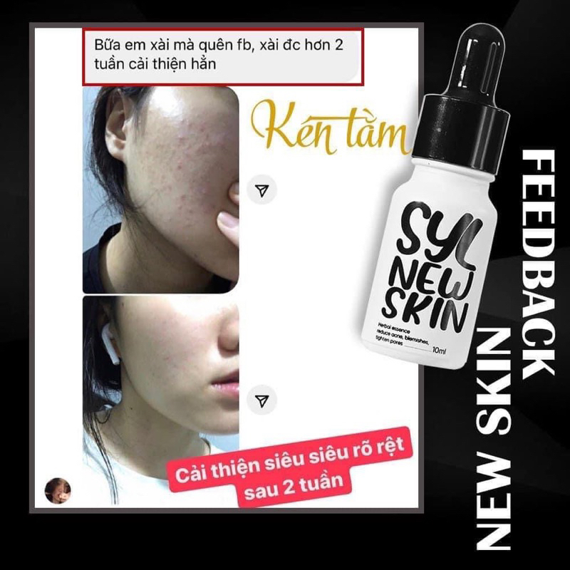 Tinh chất serum Kén Tằm New Skin ngừa mụn sau 2 tuần
