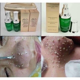 Mụn Đầu Đen Mụn Cám YOUNGERC 30ml | Đánh Bay Mụn Đầu Đen, Sạch Mụn Cám Nhanh Và Hiệu Quả