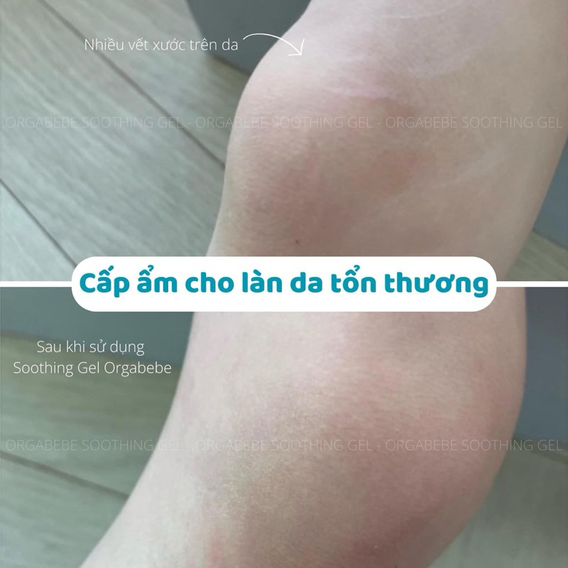 (Chính Hãng) Soothing Gel Orgabebe nội địa Hàn Quốc giúp cấp ẩm, làm dịu, làm mát da tức thì cho bé chai 150ml