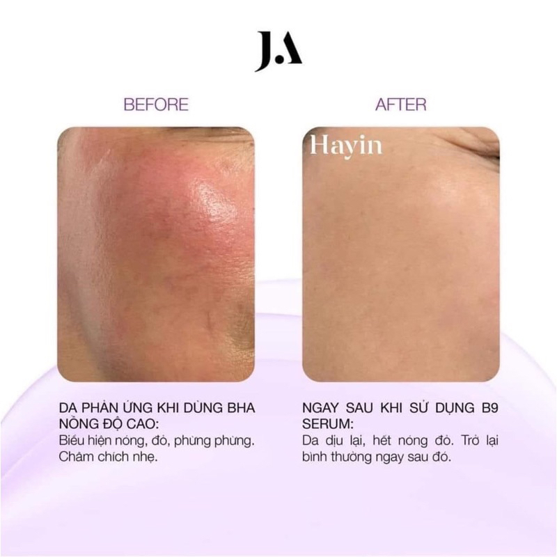 Tinh chất Folic Acid B9 phục hồi da, giảm kích ứng - Folic Acid B9 Serum Juliette Armand