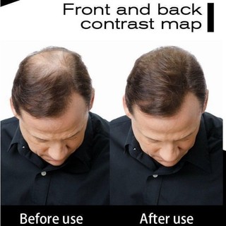 Bột Phủ Dày Tóc Thưa Tóc Hói, Che Tóc Thưa, Dặm Tóc