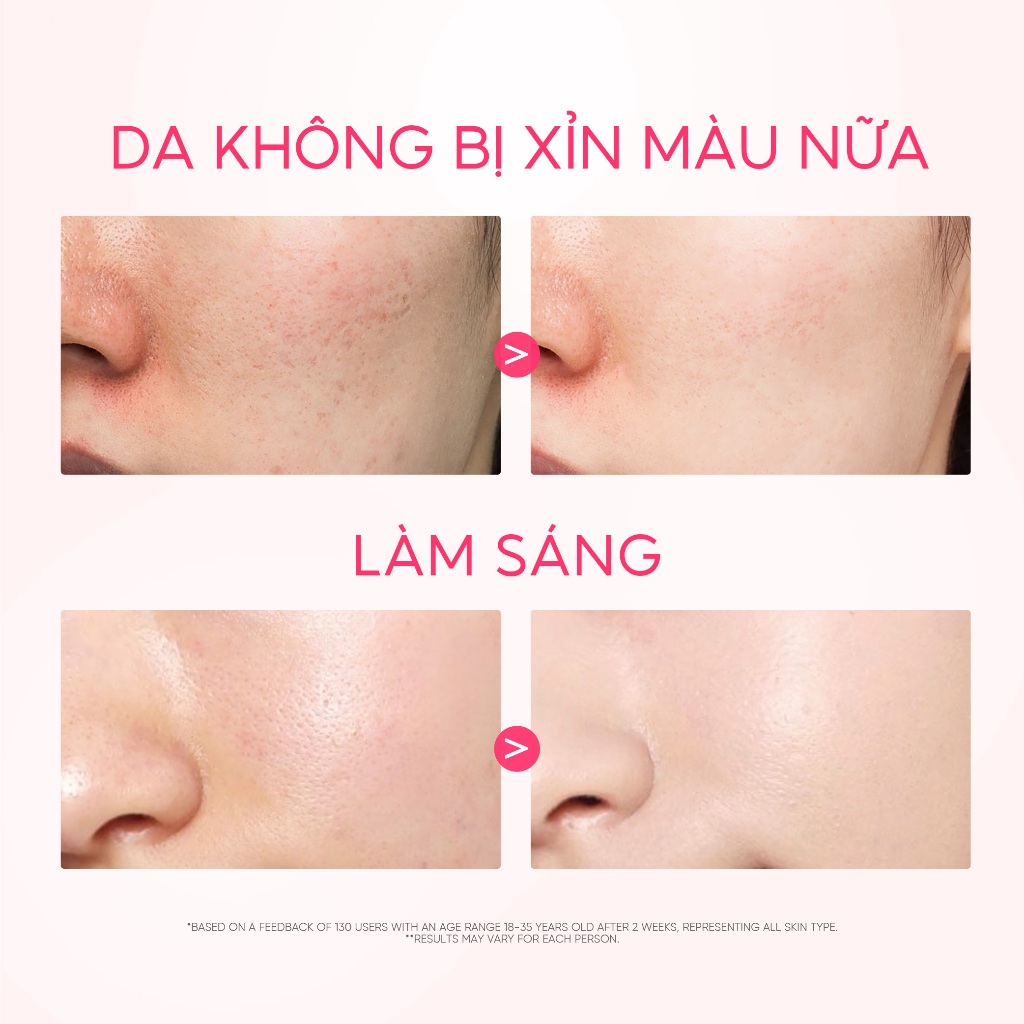 Toner Niacinamide dưỡng ẩm, cho da sáng hơn SKINTIFIC 80ml