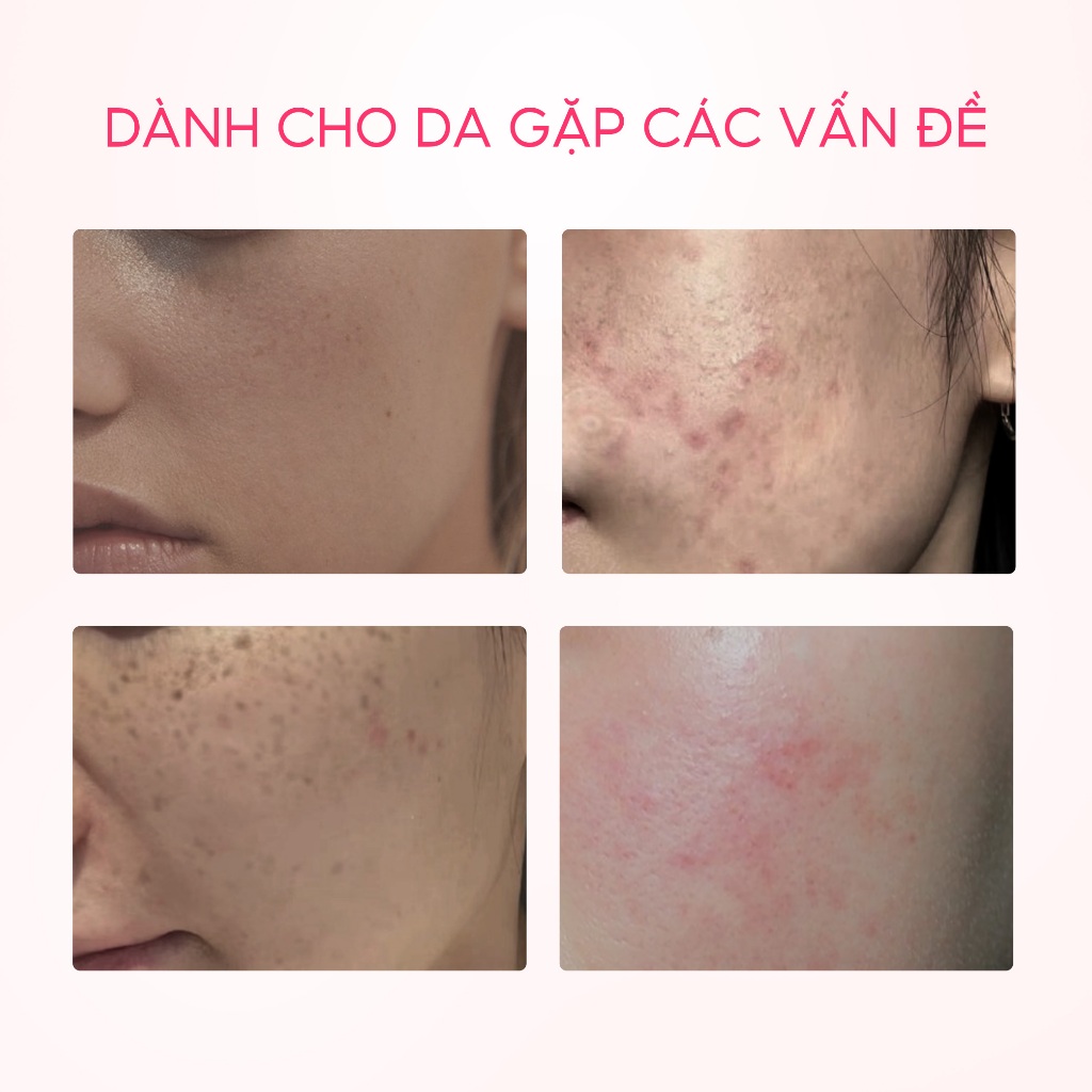 Toner Niacinamide dưỡng ẩm, cho da sáng hơn SKINTIFIC 80ml