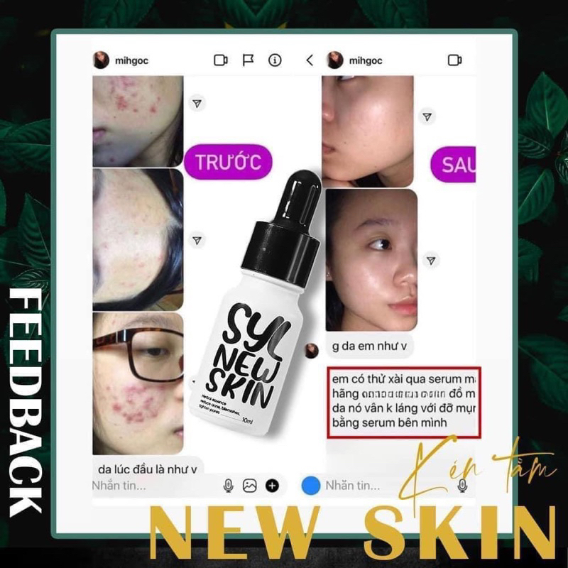 Tinh chất serum Kén Tằm New Skin ngừa mụn sau 2 tuần