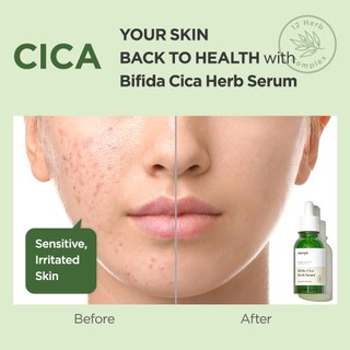 Tinh chất Ma:nyo Bifida Cica Herb Serum 50ml (Nhập khẩu chính hãng)