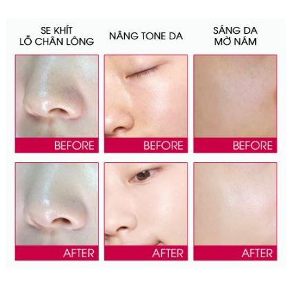 Kem Nám Dưỡng Trắng Da Mờ Nám Trắng Da Mediheal Bright Melakill Cream 35ml Hàn Quốc