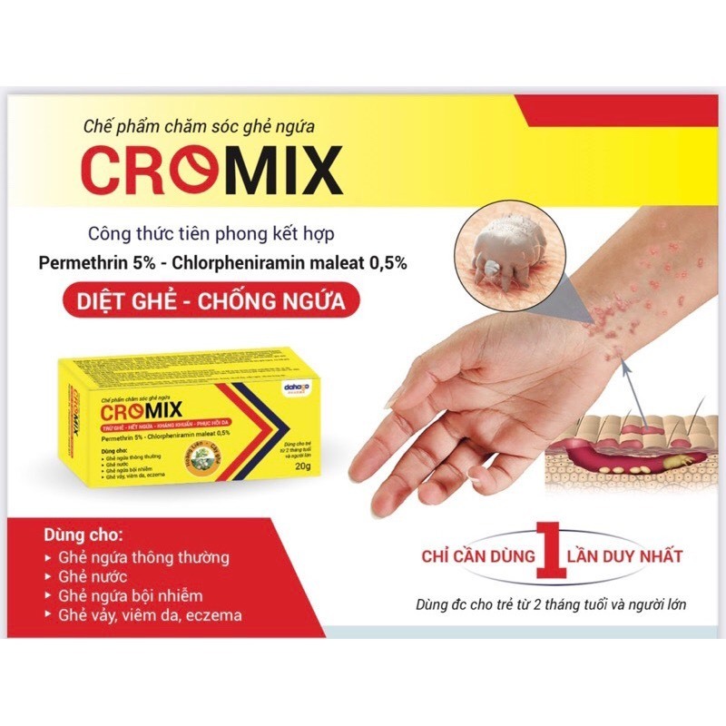 Kem diệt ghẻ CROMIX - chống ngứa chỉ cần dùng 1 lần duy nhất