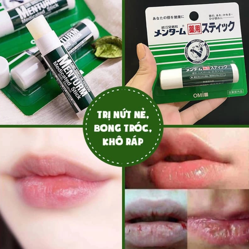 Son dưỡng môi Omi Menturm chống môi khô nứt nẻ