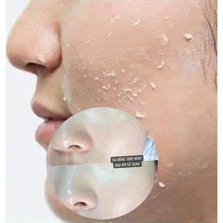 (TÚI 10 GÓI) TẨY DA CHẾT WHOO BRIGHTENING GEL