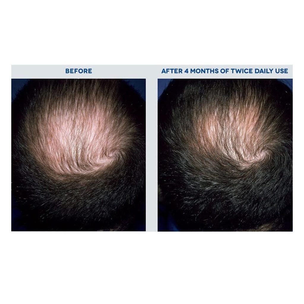 Dầu gội thảo dược thiên nhiên giảm rụng tóc Strengthening Natural Shampoo 30g