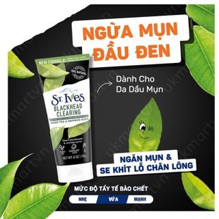 Sữa rửa mặt tẩy tế bào da chết St.Ives