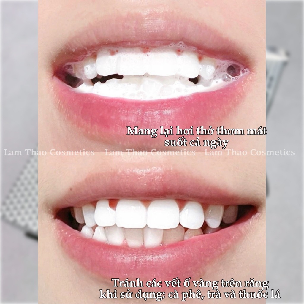 Kem Đánh Răng Cao Cấp Marvis Toothpaste 85ml