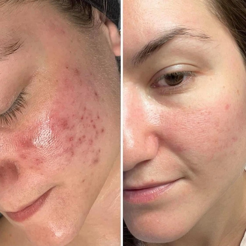 Serum phục hồi B5 Skin Ceuticals 15ml