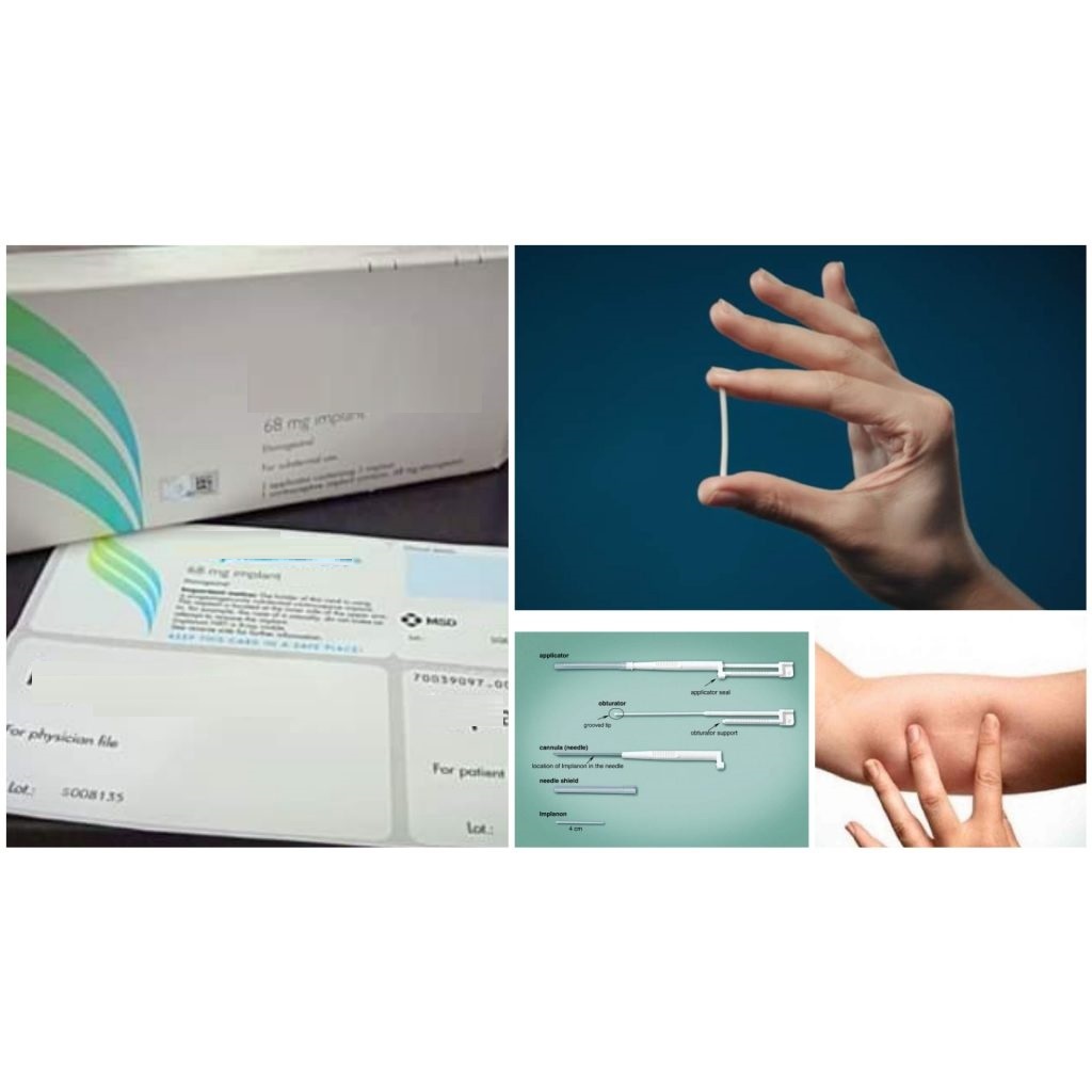 Que cấy kế hoạch