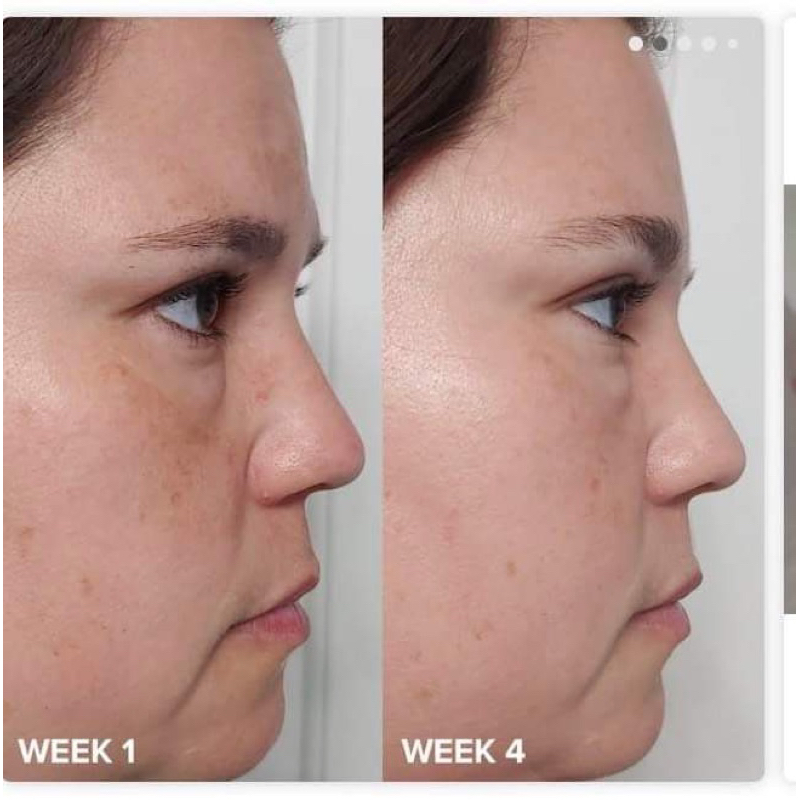 Tẩy tế bào chết BHA 2% hãng peola choice