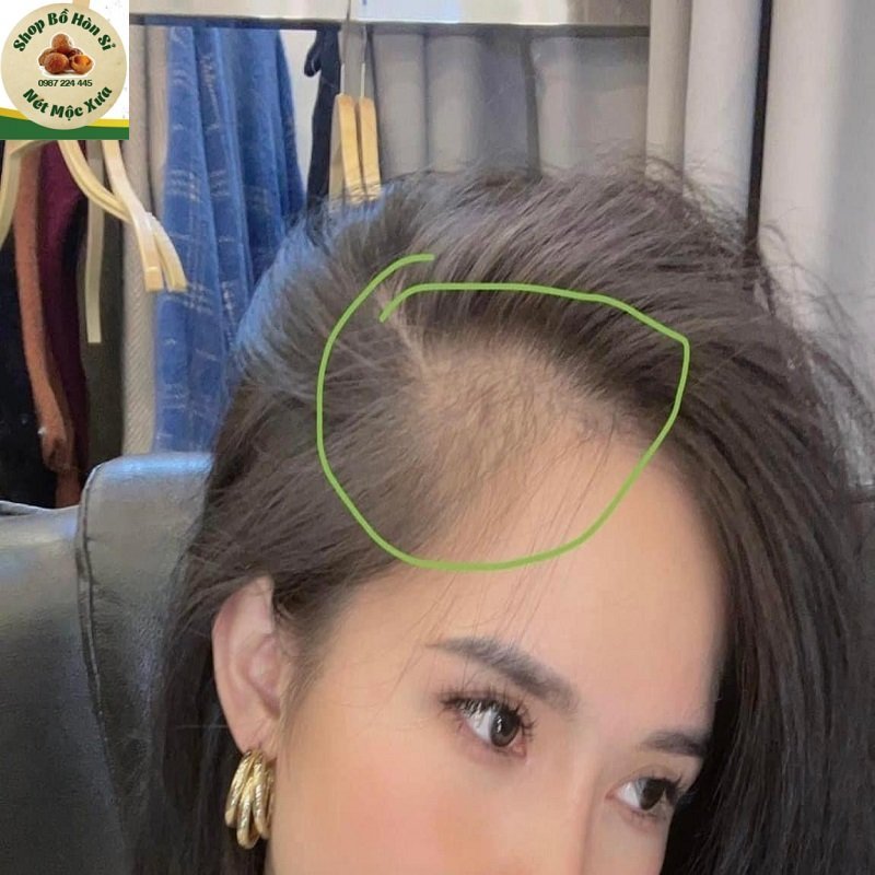 Bồ kết mix thảo dược