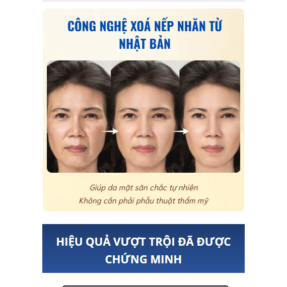 Kem xóa nhăn chính hãng Nhật Bản QINGLIN - Kem QINGLIN nâng cơ, bổ sung collagen, trẻ hóa làn da - KHỎE ĐẸP 247