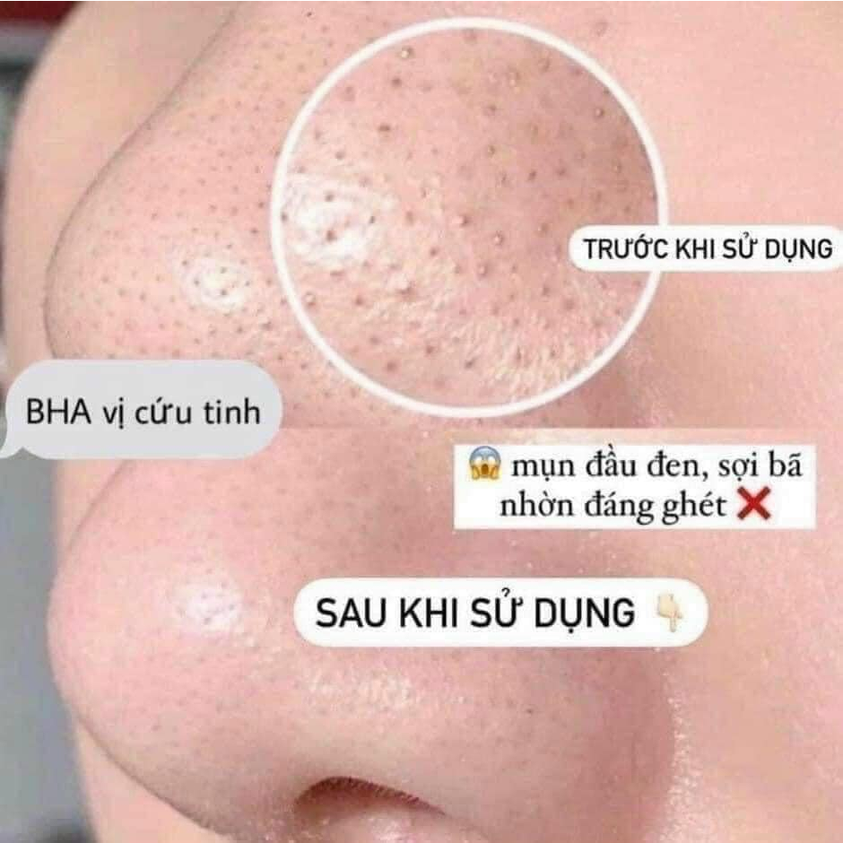 Tẩy da chết hóa học 2% BHA Pau.Choice Skin Perfecting 30ml, 118ml giảm mụn ẩn, làm sạch sâu