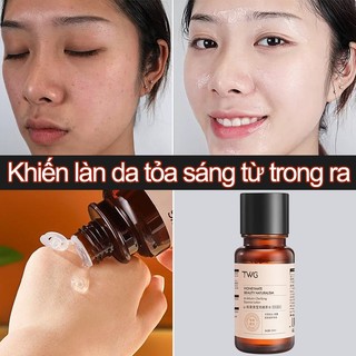 Tinh chất làm trắng Serum se khít lỗ chân lông 150ml Lột mụn đầu đen Se khít lỗ chân lông Serum mụn dưỡng trắng da mặt