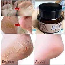 Kem nẻ dưỡng ẩm cho da 𝐡𝐮̃ 𝟑𝟎𝐠𝐫 𝐡𝐚̀𝐧𝐠 𝐧𝐨̣̂𝐢 đ𝐢̣𝐚 𝐓𝐫𝐮𝐧𝐠