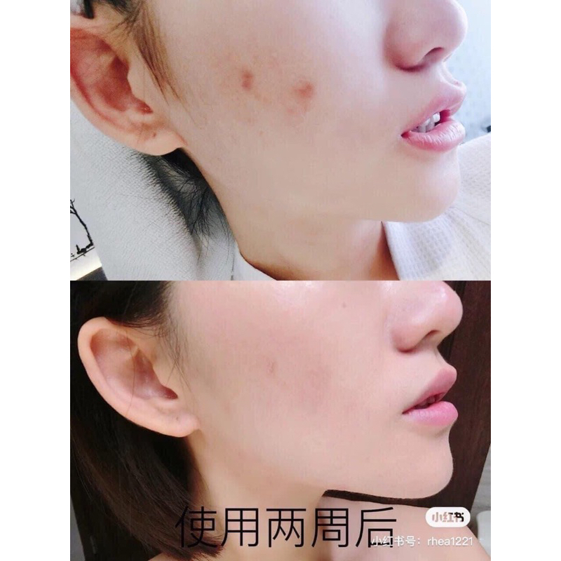 TINH CHẤT TRẺ HÓA DA SERUM LANCOME ADVANCED 100ml