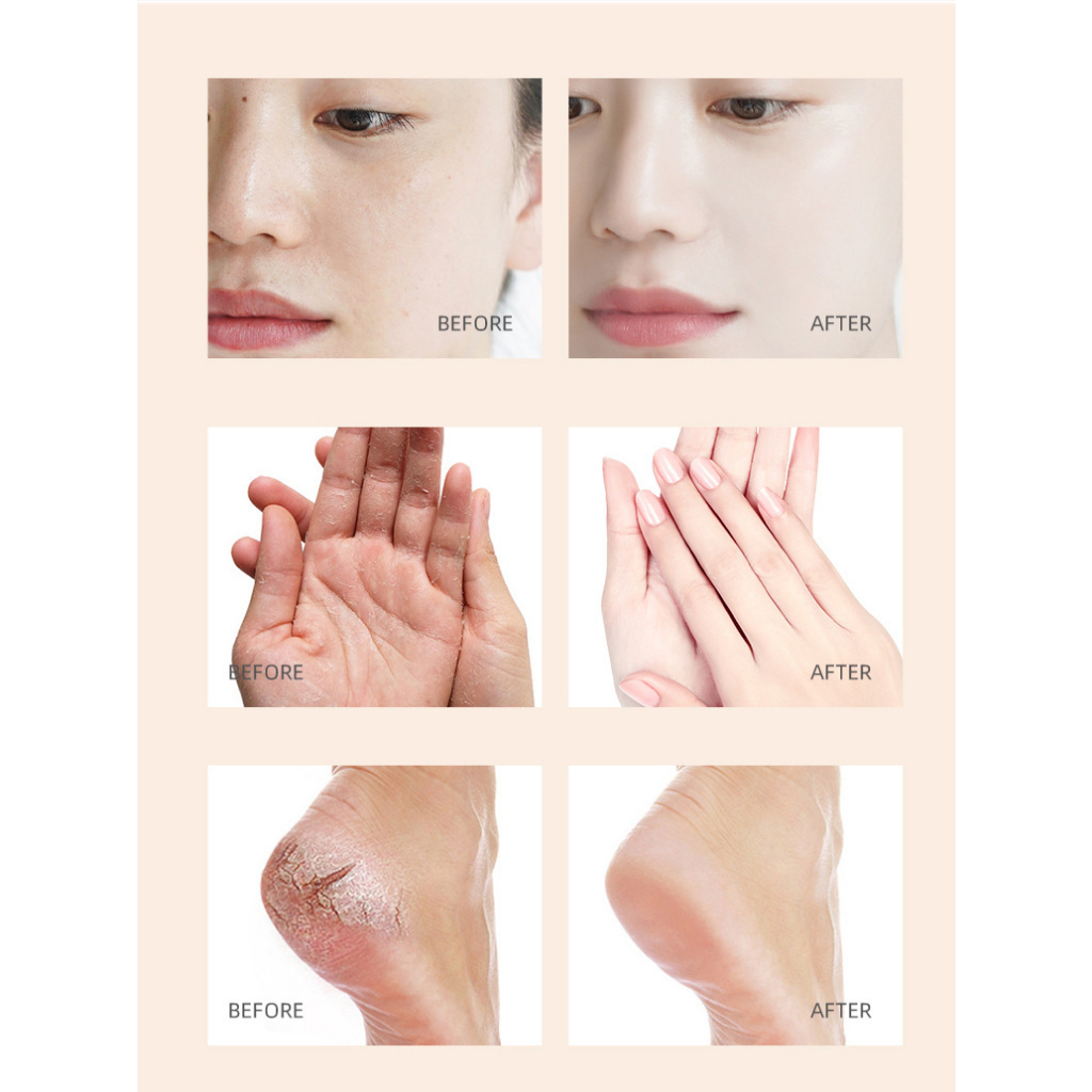 Kem Chống Nẻ , Kem Dưỡng Ẩm Chống Nứt Nẻ Da Heyxi 20g