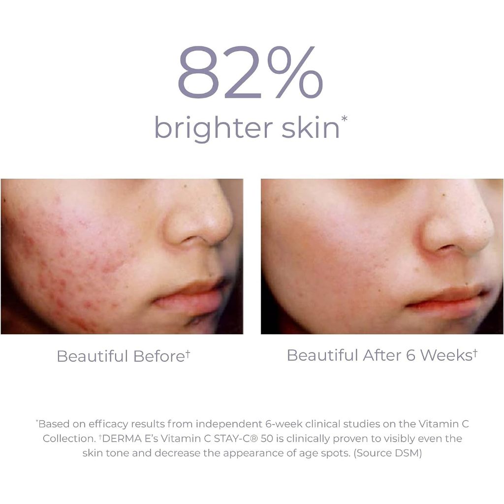 Tinh chất dưỡng ẩm và làm sáng da Serum Vitamin C Serum with Hyaluronic Acid ''DERMA-E'' 60ml