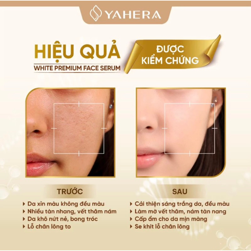 SERUM DƯỠNG TRẮNG DA CAO CẤP WHITE PREMIUM FACE SERUM - CẤP ẨM - SE KHÍT LỖ CHÂN LÔNG - PHỤC HỒI DA TỔN THƯƠNG